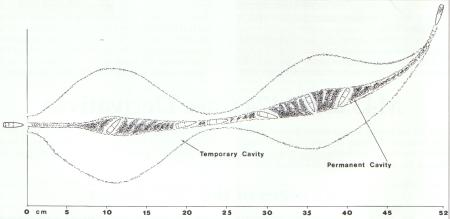 5.45mm Wound Profile